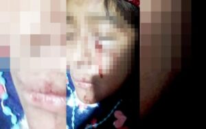 Niña de 13 es herida de bala en San Cristóbal de las Casas.